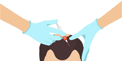 Haarproblemen? Kijk wat Dr. Don voor u kan doen